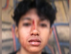 Oknum Anggota Polisi di Halmahera Selatan Diduga Aniaya Warga Obi
