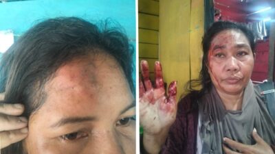 Dua IRT di Obi Jadi Korban Penganiayaan, Korban Minta Polisi Segara Tangkap Pelaku